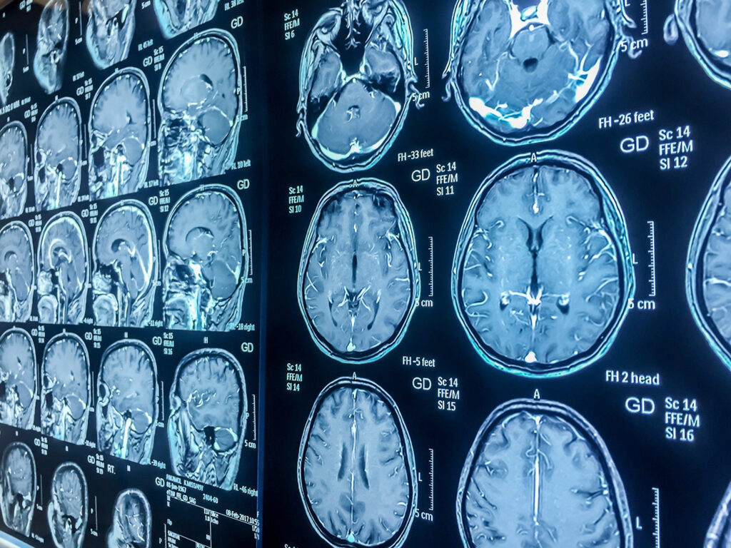 radiology brain scan